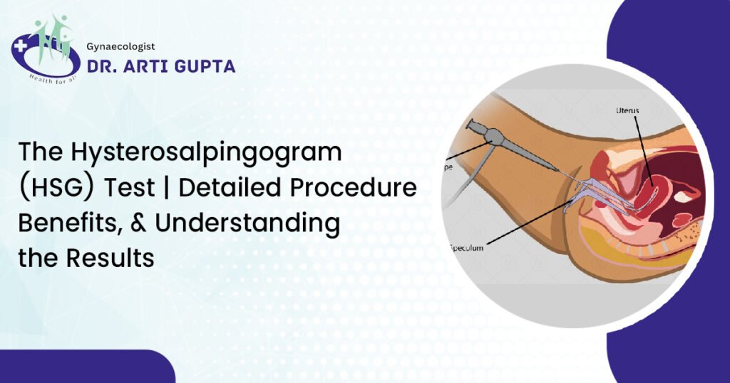 The Hysterosalpingogram (HSG) Test | Detailed Procedure, Benefits, and Understanding the Results